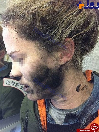 انفجار هدفون در گوش مسافر زن هواپیما +عکس