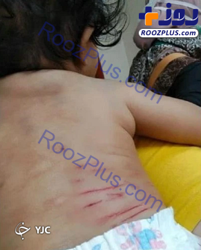 زخمی شدن نوزاد ۵ ماهه در پی حمله میمون+عکس