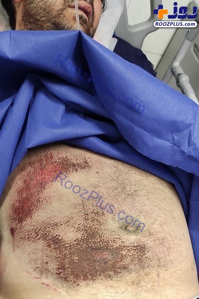 زورگیری خونین از یک عکاس خبری در تهران/ ۲۱ ضربه چاقو زدند، لنز و لپ‌تاپ و دوربین را بردند